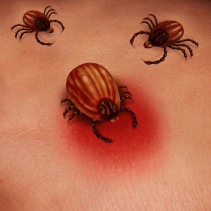 Ticks in Your Backyard? Here’s What to Watch For This Season 